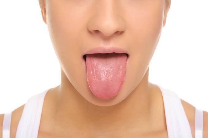 Tongue Diagnosis
